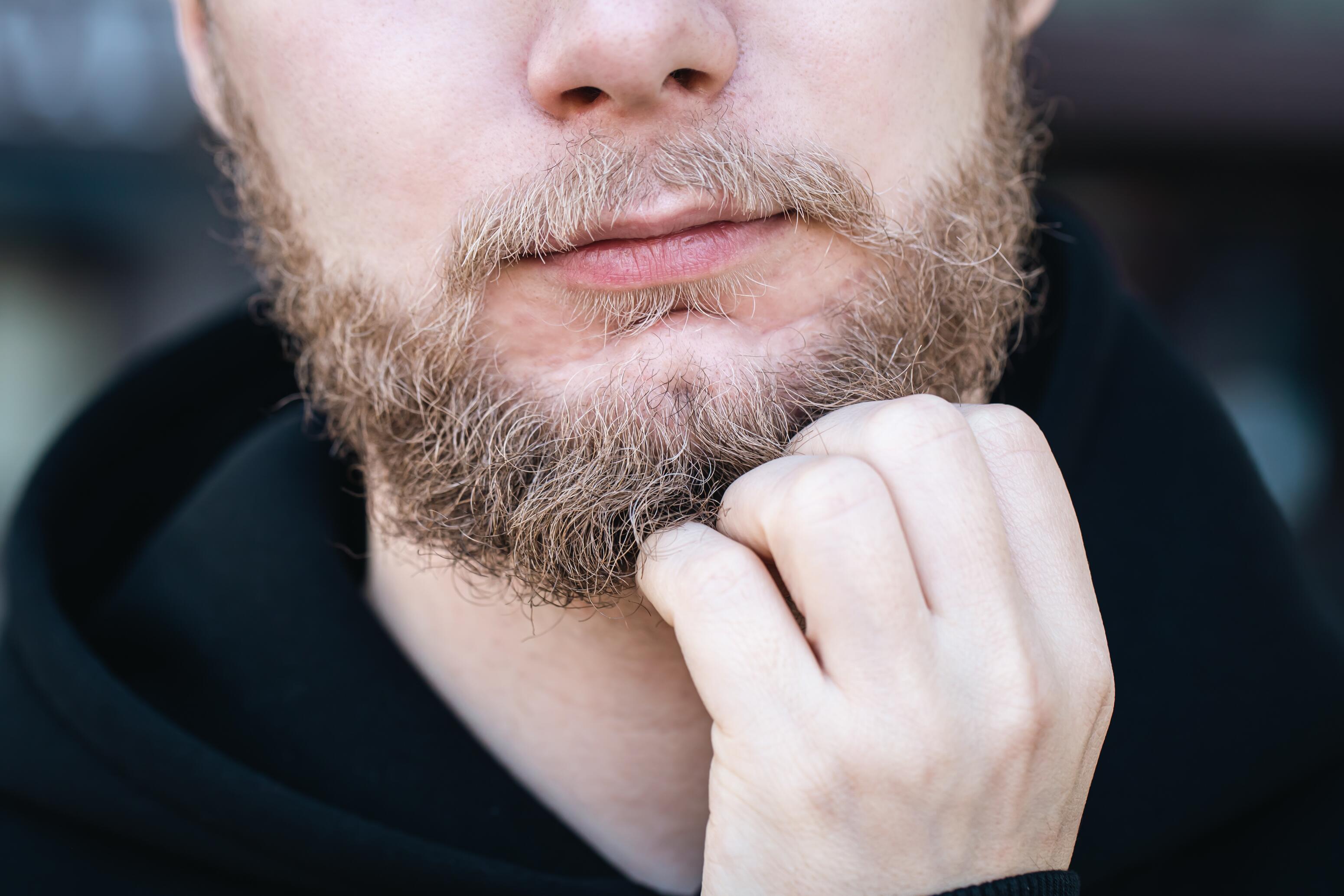 Homme présentant des pellicules de barbe